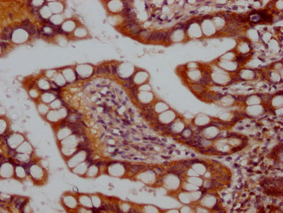 IHC image of RAC07704 diluted at 1:100 and staining in paraffin-embedded human small intestine tissue performed on a Leica BondTM system. After dewaxing and hydration, antigen retrieval was mediated by high pressure in a citrate buffer (pH 6.0). Section was blocked with 10% normal goat serum 30min at RT. Then primary antibody (1% BSA) was incubated at 4? overnight. The primary is detected by a Goat anti-rabbit IgG polymer labeled by HRP and visualized using 0.05% DAB.