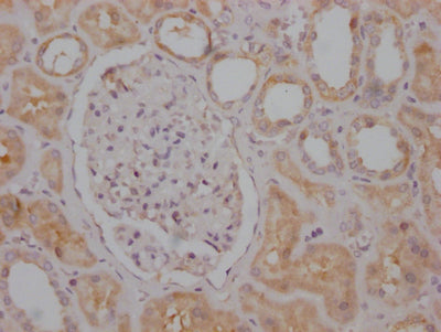 IHC image of RAC07704 diluted at 1:100 and staining in paraffin-embedded human kidney tissue performed on a Leica BondTM system. After dewaxing and hydration, antigen retrieval was mediated by high pressure in a citrate buffer (pH 6.0). Section was blocked with 10% normal goat serum 30min at RT. Then primary antibody (1% BSA) was incubated at 4? overnight. The primary is detected by a Goat anti-rabbit IgG polymer labeled by HRP and visualized using 0.05% DAB.