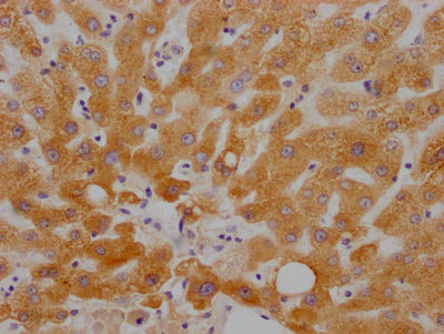 IHC image of RAC07706 diluted at 1:100 and staining in paraffin-embedded human liver tissue performed on a Leica BondTM system. After dewaxing and hydration, antigen retrieval was mediated by high pressure in a citrate buffer (pH 6.0). Section was blocked with 10% normal goat serum 30min at RT. Then primary antibody (1% BSA) was incubated at 4? overnight. The primary is detected by a Goat anti-rabbit IgG polymer labeled by HRP and visualized using 0.05% DAB.