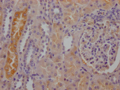 IHC image of RAC07706 diluted at 1:100 and staining in paraffin-embedded human kidney tissue performed on a Leica BondTM system. After dewaxing and hydration, antigen retrieval was mediated by high pressure in a citrate buffer (pH 6.0). Section was blocked with 10% normal goat serum 30min at RT. Then primary antibody (1% BSA) was incubated at 4? overnight. The primary is detected by a Goat anti-rabbit IgG polymer labeled by HRP and visualized using 0.05% DAB.