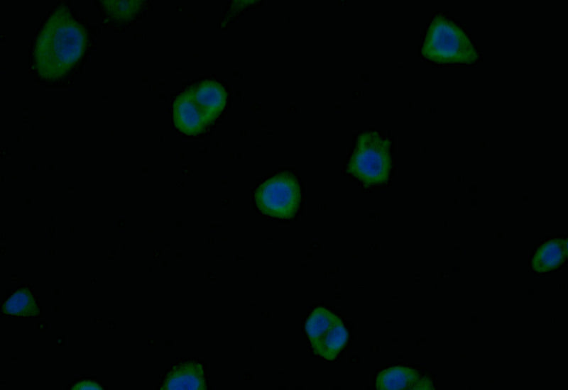 Immunofluorescence staining of PC-3 with RAC07707 at 1:15, counter-stained with DAPI. The cells were fixed in 4% formaldehyde and blocked in 10% normal Goat Serum. The cells were then incubated with the antibody overnight at 4Â°C. The secondary antibody was Alexa Fluor 496-congugated AffiniPure Goat Anti-Rabbit IgG(H+L).