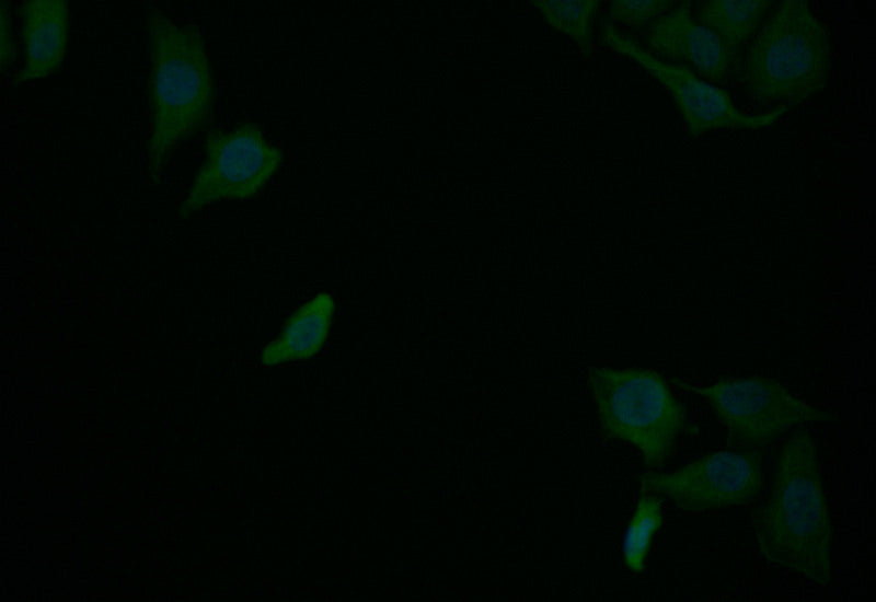 Immunofluorescence staining of Hela with RAC07708 at 1:25, counter-stained with DAPI. The cells were fixed in 4% formaldehyde and blocked in 10% normal Goat Serum. The cells were then incubated with the antibody overnight at 4Â°C. The secondary antibody was Alexa Fluor 507-congugated AffiniPure Goat Anti-Rabbit IgG(H+L).