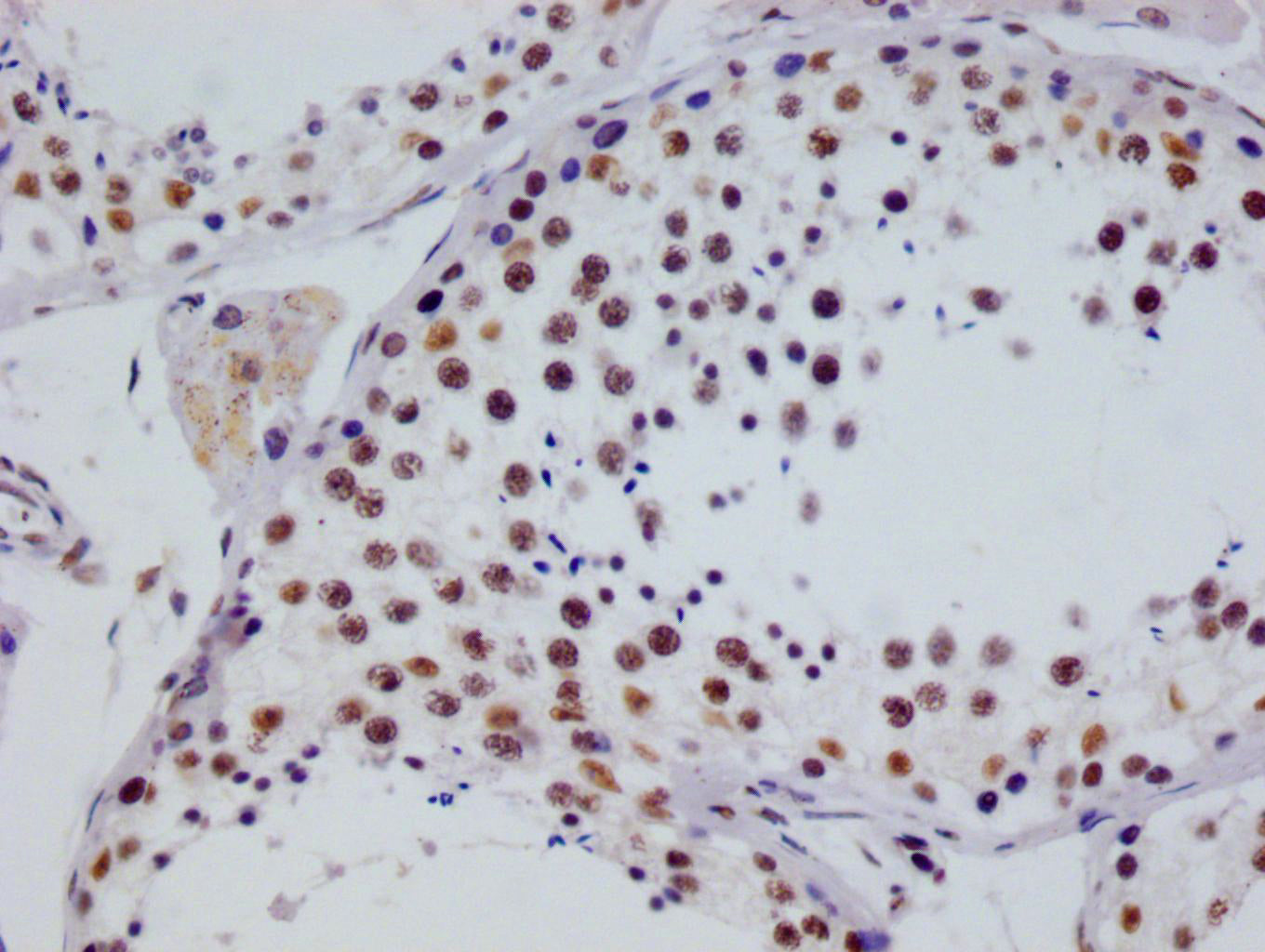IHC image of RAC07710 diluted at 1:100 and staining in paraffin-embedded human testis tissue performed on a Leica BondTM system. After dewaxing and hydration, antigen retrieval was mediated by high pressure in a citrate buffer (pH 6.0). Section was blocked with 10% normal goat serum 30min at RT. Then primary antibody (1% BSA) was incubated at 4Â°C overnight. The primary is detected by a Goat anti-rabbit polymer IgG labeled by HRP and visualized using 0.05% DAB.