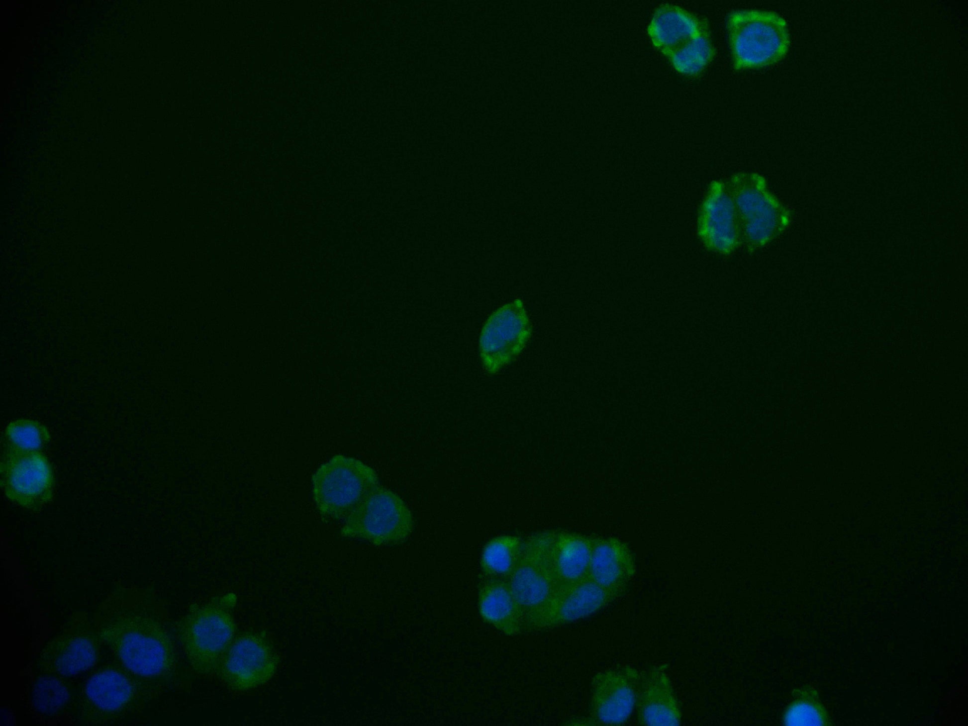 Immunofluorescence staining of PC-3 cell with RAC07710 at 1:50, counter-stained with DAPI. The cells were fixed in 4% formaldehyde and blocked in 10% normal Goat Serum. The cells were then incubated with the antibody overnight at 4Â°C. The secondary antibody was Alexa Fluor 592-congugated AffiniPure Goat Anti-Rabbit IgG(H+L).