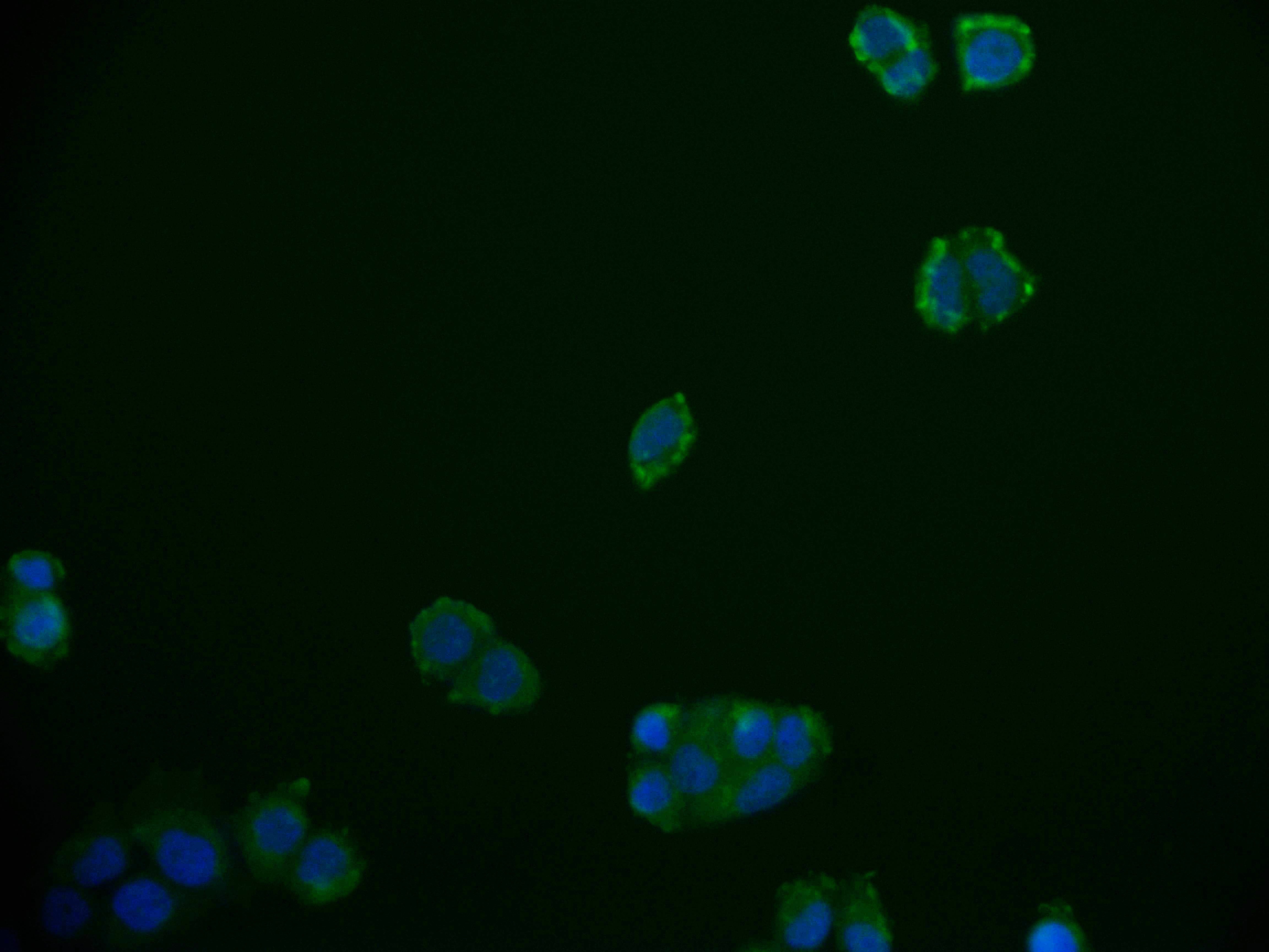 Immunofluorescence staining of PC-3 cell with RAC07710 at 1:50, counter-stained with DAPI. The cells were fixed in 4% formaldehyde and blocked in 10% normal Goat Serum. The cells were then incubated with the antibody overnight at 4Â°C. The secondary antibody was Alexa Fluor 592-congugated AffiniPure Goat Anti-Rabbit IgG(H+L).