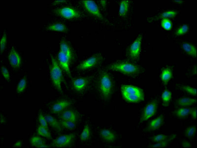 Immunofluorescence staining of Hela Cells with RAC07711 at 1:50, counter-stained with DAPI. The cells were fixed in 4% formaldehyde, permeated by 0.2% TritonX-100, and blocked in 10% normal Goat Serum. The cells were then incubated with the antibody overnight at 4?. Nuclear DNA was labeled in blue with DAPI. The secondary antibody was FITC-conjugated AffiniPure Goat Anti-Rabbit IgG (H+L).