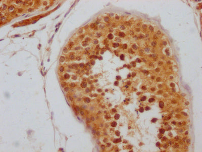 IHC image of RAC07715 diluted at 1:100 and staining in paraffin-embedded human testis tissue performed on a Leica BondTM system. After dewaxing and hydration, antigen retrieval was mediated by high pressure in a citrate buffer (pH 6.0). Section was blocked with 10% normal goat serum 30min at RT. Then primary antibody (1% BSA) was incubated at 4? overnight. The primary is detected by a Goat anti-rabbit IgG polymer labeled by HRP and visualized using 0.05% DAB.