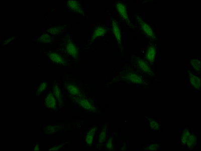 Immunofluorescence staining of Hela Cells with RAC07715 at 1:50, counter-stained with DAPI. The cells were fixed in 4% formaldehyde, permeated by 0.2% TritonX-100, and blocked in 10% normal Goat Serum. The cells were then incubated with the antibody overnight at 4?. Nuclear DNA was labeled in blue with DAPI. The secondary antibody was FITC-conjugated AffiniPure Goat Anti-Rabbit IgG (H+L).
