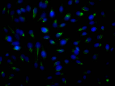 Immunofluorescence staining of Hela Cells with RAC07716 at 1:50, counter-stained with DAPI. The cells were fixed in 4% formaldehyde, permeated by 0.2% TritonX-100, and blocked in 10% normal Goat Serum. The cells were then incubated with the antibody overnight at 4?. Nuclear DNA was labeled in blue with DAPI. The secondary antibody was FITC-conjugated AffiniPure Goat Anti-Rabbit IgG (H+L).