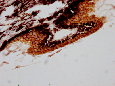 IHC image of RAC07717 diluted at 1:100 and staining in paraffin-embedded human eye tissue performed on a Leica BondTM system. After dewaxing and hydration, antigen retrieval was mediated by high pressure in a citrate buffer (pH 6.0). Section was blocked with 10% normal goat serum 30min at RT. Then primary antibody (1% BSA) was incubated at 4? overnight. The primary is detected by a Goat anti-rabbit IgG polymer labeled by HRP and visualized using 0.05% DAB.