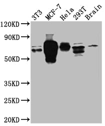 Western Blot; Positive WB detected in: NIH/3T3 whole cell lysate, MCF-7 whole cell lysate, Hela whole cell lysate, 293T whole cell lysate, Mouse Brain whole cell lysate; All lanes: S6K1 antibody at 1:1000; Secondary; Goat polyclonal to rabbit IgG at 1/50000 dilution; Predicted band size: 60, 57, 53, 57, 52 kDa; Observed band size: 70 kDa