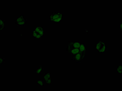 Immunofluorescence staining of MCF7 Cells with RAC07721 at 1:50, counter-stained with DAPI. The cells were fixed in 4% formaldehyde, permeated by 0.2% TritonX-100, and blocked in 10% normal Goat Serum. The cells were then incubated with the antibody overnight at 4?. Nuclear DNA was labeled in blue with DAPI. The secondary antibody was FITC-conjugated AffiniPure Goat Anti-Rabbit IgG (H+L).