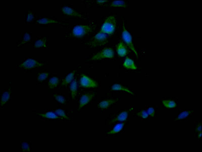 Immunofluorescence staining of Hela Cells with RAC07723 at 1:50, counter-stained with DAPI. The cells were fixed in 4% formaldehyde, permeated by 0.2% TritonX-100, and blocked in 10% normal Goat Serum. The cells were then incubated with the antibody overnight at 4?. Nuclear DNA was labeled in blue with DAPI. The secondary antibody was FITC-conjugated AffiniPure Goat Anti-Rabbit IgG (H+L).