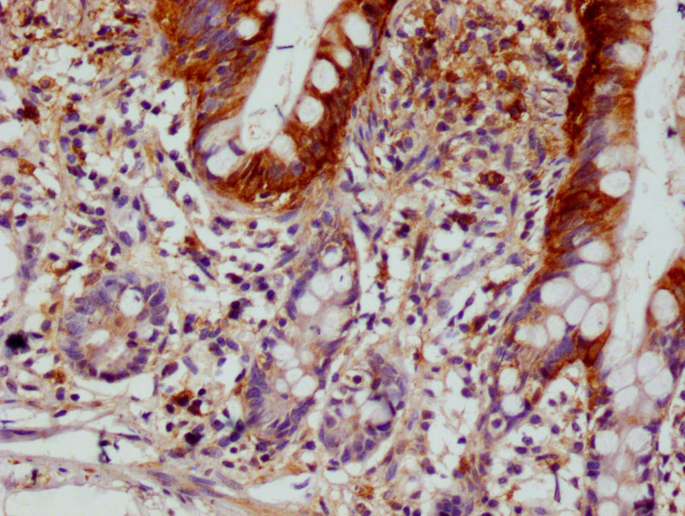 IHC image of RAC07726 diluted at 1:100 and staining in paraffin-embedded human small intestine tissue performed on a Leica BondTM system. After dewaxing and hydration, antigen retrieval was mediated by high pressure in a citrate buffer (pH 6.0). Section was blocked with 10% normal goat serum 30min at RT. Then primary antibody (1% BSA) was incubated at 4Â°C overnight. The primary is detected by a Goat anti-rabbit polymer IgG labeled by HRP and visualized using 0.05% DAB.