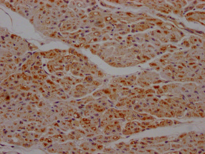IHC image of RAC07728 diluted at 1:100 and staining in paraffin-embedded human heart tissue performed on a Leica BondTM system. After dewaxing and hydration, antigen retrieval was mediated by high pressure in a citrate buffer (pH 6.0). Section was blocked with 10% normal goat serum 30min at RT. Then primary antibody (1% BSA) was incubated at 4? overnight. The primary is detected by a Goat anti-rabbit IgG polymer labeled by HRP and visualized using 0.05% DAB.