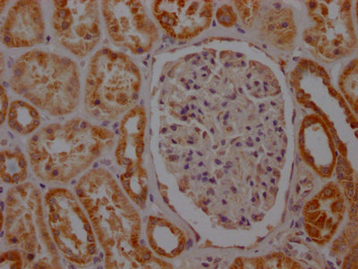 IHC image of RAC07728 diluted at 1:100 and staining in paraffin-embedded human kidney tissue performed on a Leica BondTM system. After dewaxing and hydration, antigen retrieval was mediated by high pressure in a citrate buffer (pH 6.0). Section was blocked with 10% normal goat serum 30min at RT. Then primary antibody (1% BSA) was incubated at 4? overnight. The primary is detected by a Goat anti-rabbit IgG polymer labeled by HRP and visualized using 0.05% DAB.