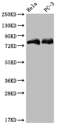 Western Blot; Positive WB detected in: Hela whole cell lysate, PC3 whole cell lysate; All lanes: SENP1 antibody at 1:2000; Secondary; Goat polyclonal to rabbit IgG at 1/50000 dilution; Predicted band size: 74 kDa; Observed band size: 72-95 kDa
