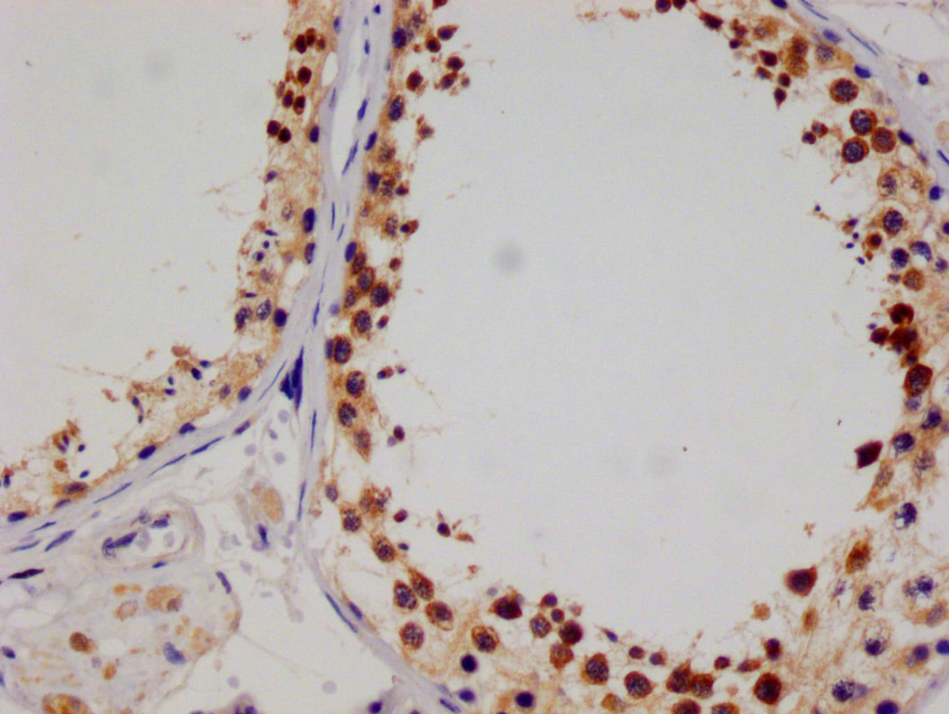IHC image of RAC07729 diluted at 1:100 and staining in paraffin-embedded human testis tissue performed on a Leica BondTM system. After dewaxing and hydration, antigen retrieval was mediated by high pressure in a citrate buffer (pH 6.0). Section was blocked with 10% normal goat serum 30min at RT. Then primary antibody (1% BSA) was incubated at 4Â°C overnight. The primary is detected by a Goat anti-rabbit polymer IgG labeled by HRP and visualized using 0.05% DAB.
