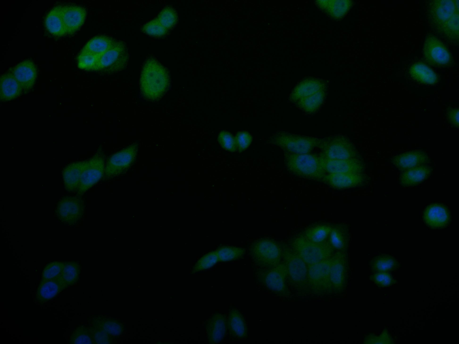 Immunofluorescence staining of PC-3 cell with RAC07729 at 1:50, counter-stained with DAPI. The cells were fixed in 4% formaldehyde and blocked in 10% normal Goat Serum. The cells were then incubated with the antibody overnight at 4Â°C. The secondary antibody was Alexa Fluor 527-congugated AffiniPure Goat Anti-Rabbit IgG(H+L).
