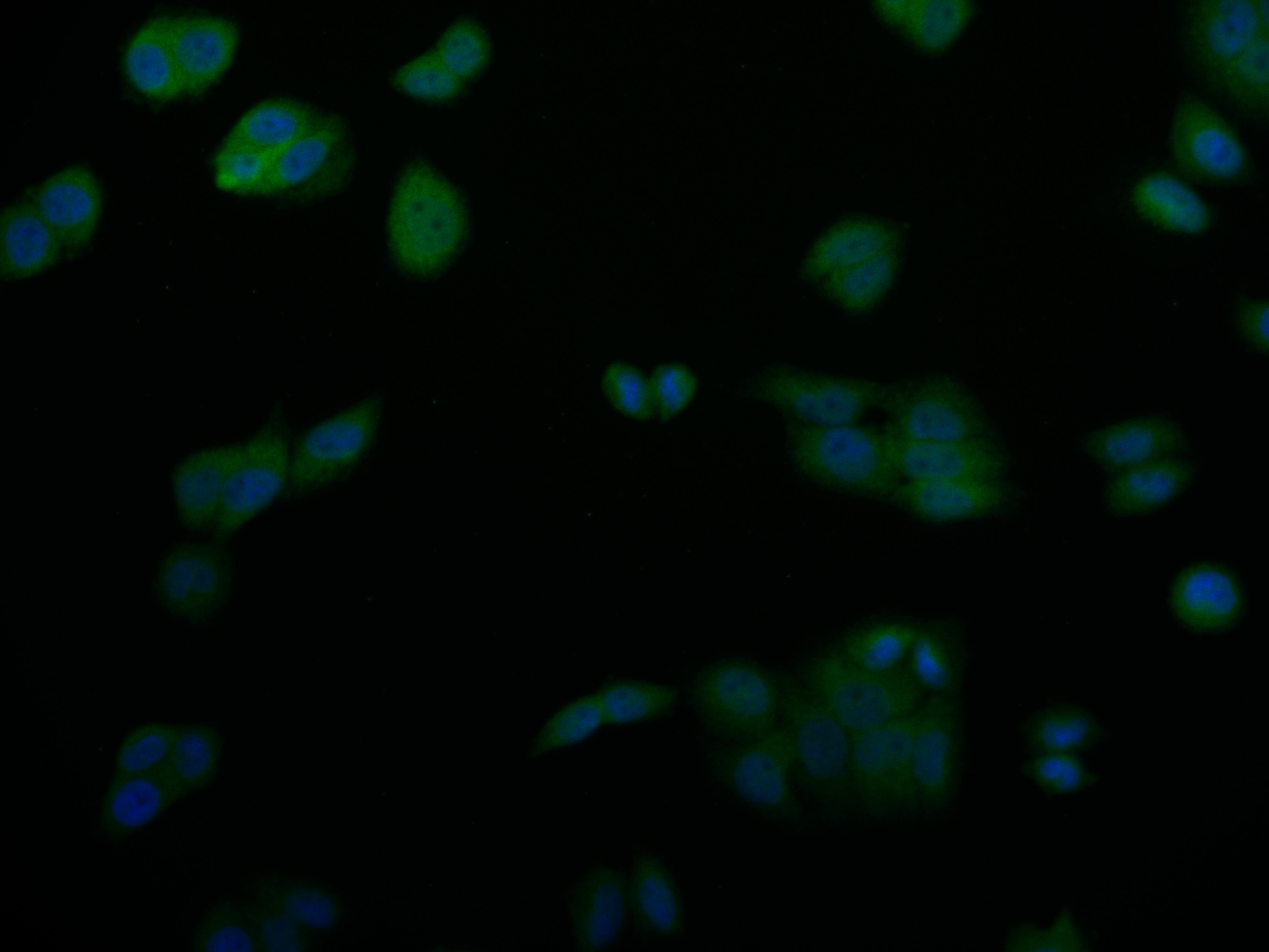 Immunofluorescence staining of PC-3 cell with RAC07729 at 1:50, counter-stained with DAPI. The cells were fixed in 4% formaldehyde and blocked in 10% normal Goat Serum. The cells were then incubated with the antibody overnight at 4Â°C. The secondary antibody was Alexa Fluor 527-congugated AffiniPure Goat Anti-Rabbit IgG(H+L).