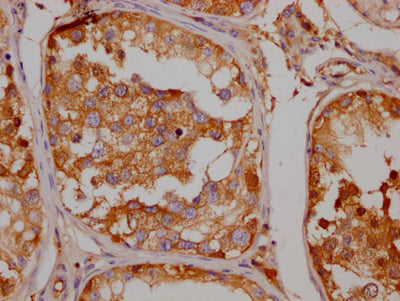IHC image of RAC07730 diluted at 1:100 and staining in paraffin-embedded human testis tissue performed on a Leica BondTM system. After dewaxing and hydration, antigen retrieval was mediated by high pressure in a citrate buffer (pH 6.0). Section was blocked with 10% normal goat serum 30min at RT. Then primary antibody (1% BSA) was incubated at 4? overnight. The primary is detected by a Goat anti-rabbit IgG polymer labeled by HRP and visualized using 0.05% DAB.