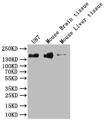Western Blot; Positive WB detected in: Hela whole cell lysate, K562 whole cell lysate, U-87 whole cell lysate, Mouse Brain whole cell lysate; All lanes: SF3B1 antibody at 1:1000; Secondary; Goat polyclonal to rabbit IgG at 1/50000 dilution; Predicted band size: 146, 17 kDa; Observed band size: 130 kDa