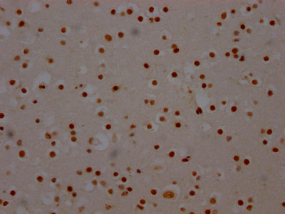 IHC image of RAC07731 diluted at 1:100 and staining in paraffin-embedded human brain tissue performed on a Leica BondTM system. After dewaxing and hydration, antigen retrieval was mediated by high pressure in a citrate buffer (pH 6.0). Section was blocked with 10% normal goat serum 30min at RT. Then primary antibody (1% BSA) was incubated at 4? overnight. The primary is detected by a Goat anti-rabbit IgG polymer labeled by HRP and visualized using 0.05% DAB.