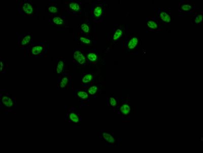 Immunofluorescence staining of Hela Cells with RAC07731 at 1:50, counter-stained with DAPI. The cells were fixed in 4% formaldehyde, permeated by 0.2% TritonX-100, and blocked in 10% normal Goat Serum. The cells were then incubated with the antibody overnight at 4?. Nuclear DNA was labeled in blue with DAPI. The secondary antibody was FITC-conjugated AffiniPure Goat Anti-Rabbit IgG (H+L).