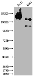 Western Blot; Positive WB detected in: Raji whole cell lysate, K562 whole cell lysate; All lanes: INPP5D antibody at 1:1500; Secondary; Goat polyclonal to rabbit IgG at 1/50000 dilution; Predicted band size: 134, 110 kDa; Observed band size: 145 kDa