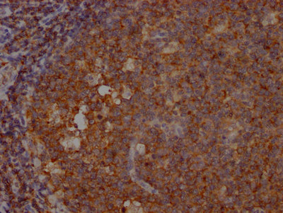 IHC image of RAC07732 diluted at 1:100 and staining in paraffin-embedded human tonsil tissue performed on a Leica BondTM system. After dewaxing and hydration, antigen retrieval was mediated by high pressure in a citrate buffer (pH 6.0). Section was blocked with 10% normal goat serum 30min at RT. Then primary antibody (1% BSA) was incubated at 4? overnight. The primary is detected by a Goat anti-rabbit IgG polymer labeled by HRP and visualized using 0.05% DAB.