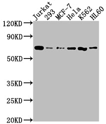 Western Blot; Positive WB detected in: Jurkat whole cell lysate, 293 whole cell lysate, MCF-7 whole cell lysate, Hela whole cell lysate, K562 whole cell lysate, HL60 whole cell lysate; All lanes: PTPN11 antibody at 1:2000; Secondary; Goat polyclonal to rabbit IgG at 1/50000 dilution; Predicted band size: 69, 53 kDa; Observed band size: 69 kDa