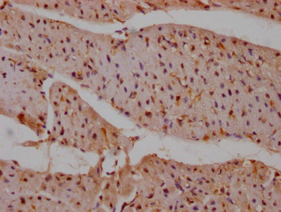 IHC image of RAC07733 diluted at 1:100 and staining in paraffin-embedded human heart tissue performed on a Leica BondTM system. After dewaxing and hydration, antigen retrieval was mediated by high pressure in a citrate buffer (pH 6.0). Section was blocked with 10% normal goat serum 30min at RT. Then primary antibody (1% BSA) was incubated at 4? overnight. The primary is detected by a Goat anti-rabbit IgG polymer labeled by HRP and visualized using 0.05% DAB.