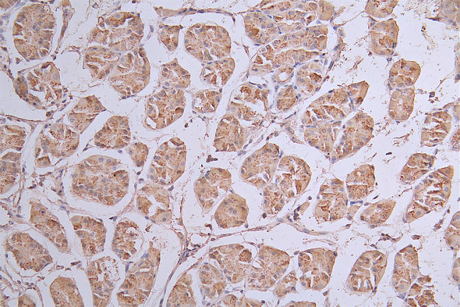 IHC image of RAC07735 diluted at 1:50 and staining in paraffin-embedded human stomach tissue performed on a Leica BondTM system. After dewaxing and hydration, antigen retrieval was mediated by high pressure in a citrate buffer (pH 6.0). Section was blocked with 10% normal goat serum 30min at RT. Then primary antibody (1% BSA) was incubated at 4Â°C overnight. The primary is detected by a Goat anti-rabbit polymer IgG labeled by HRP and visualized using 0.13% DAB.