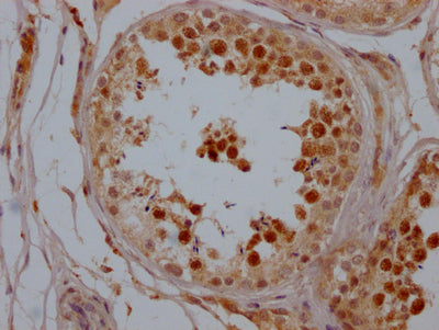 IHC image of RAC07736 diluted at 1:100 and staining in paraffin-embedded human testis tissue performed on a Leica BondTM system. After dewaxing and hydration, antigen retrieval was mediated by high pressure in a citrate buffer (pH 6.0). Section was blocked with 10% normal goat serum 30min at RT. Then primary antibody (1% BSA) was incubated at 4? overnight. The primary is detected by a Goat anti-rabbit IgG polymer labeled by HRP and visualized using 0.05% DAB.