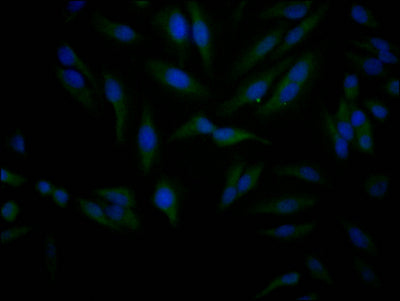 Immunofluorescence staining of Hela Cells with RAC07736 at 1:50, counter-stained with DAPI. The cells were fixed in 4% formaldehyde, permeated by 0.2% TritonX-100, and blocked in 10% normal Goat Serum. The cells were then incubated with the antibody overnight at 4?. Nuclear DNA was labeled in blue with DAPI. The secondary antibody was FITC-conjugated AffiniPure Goat Anti-Rabbit IgG (H+L).