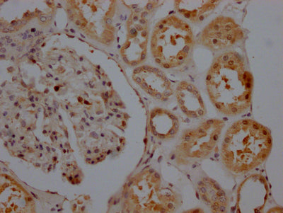 IHC image of RAC07737 diluted at 1:100 and staining in paraffin-embedded human kidney tissue performed on a Leica BondTM system. After dewaxing and hydration, antigen retrieval was mediated by high pressure in a citrate buffer (pH 6.0). Section was blocked with 10% normal goat serum 30min at RT. Then primary antibody (1% BSA) was incubated at 4? overnight. The primary is detected by a Goat anti-rabbit IgG polymer labeled by HRP and visualized using 0.05% DAB.