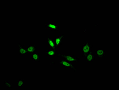 Immunofluorescence staining of HepG2 Cells with RAC07738 at 1:50, counter-stained with DAPI. The cells were fixed in 4% formaldehyde, permeated by 0.2% TritonX-100, and blocked in 10% normal Goat Serum. The cells were then incubated with the antibody overnight at 4?. Nuclear DNA was labeled in blue with DAPI. The secondary antibody was FITC-conjugated AffiniPure Goat Anti-Rabbit IgG (H+L).