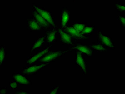 Immunofluorescence staining of Hela Cells with RAC07739 at 1:50, counter-stained with DAPI. The cells were fixed in 4% formaldehyde, permeated by 0.2% TritonX-100, and blocked in 10% normal Goat Serum. The cells were then incubated with the antibody overnight at 4?. Nuclear DNA was labeled in blue with DAPI. The secondary antibody was FITC-conjugated AffiniPure Goat Anti-Rabbit IgG (H+L).