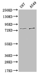 Western Blot; Positive WB detected in: U87 whole cell lysate, A549 whole cell lysate; All lanes: SLC25A12 antibody at 1:1000; Secondary; Goat polyclonal to rabbit IgG at 1/50000 dilution; Predicted band size: 75, 63 kDa; Observed band size: 72-80 kDa
