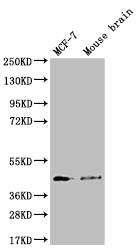 Western Blot; Positive WB detected in: MCF-7 whole cell lysate, Mouse brain tissue; All lanes: SLC27A4 antibody at 1:1000; Secondary; Goat polyclonal to rabbit IgG at 1/50000 dilution; Predicted band size: 73, 27 kDa; Observed band size: 42 kDa