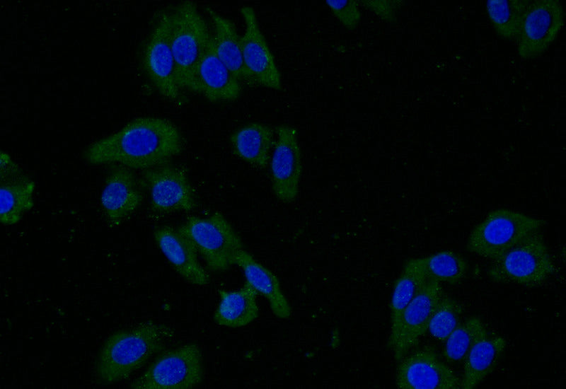 Immunofluorescence staining of HepG2 with RAC07743 at 1:25, counter-stained with DAPI. The cells were fixed in 4% formaldehyde and blocked in 10% normal Goat Serum. The cells were then incubated with the antibody overnight at 4Â°C. The secondary antibody was Alexa Fluor 495-congugated AffiniPure Goat Anti-Rabbit IgG(H+L).