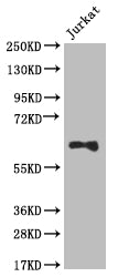 Western Blot; Positive WB detected in: Jurkat whole cell lysate; All lanes: SLC2A3 antibody at 1:1000; Secondary; Goat polyclonal to rabbit IgG at 1/50000 dilution; Predicted band size: 54 kDa; Observed band size: 55-70 kDa