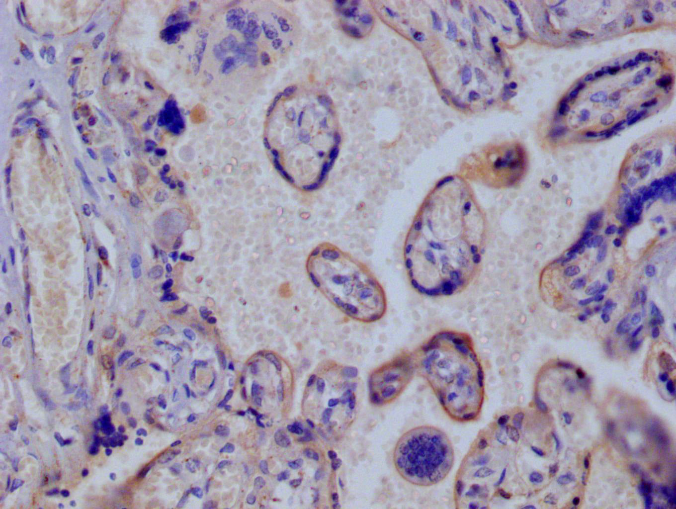 IHC image of RAC07744 diluted at 1:100 and staining in paraffin-embedded human placenta tissue performed on a Leica BondTM system. After dewaxing and hydration, antigen retrieval was mediated by high pressure in a citrate buffer (pH 6.0). Section was blocked with 10% normal goat serum 30min at RT. Then primary antibody (1% BSA) was incubated at 4Â°C overnight. The primary is detected by a Goat anti-rabbit polymer IgG labeled by HRP and visualized using 0.05% DAB.