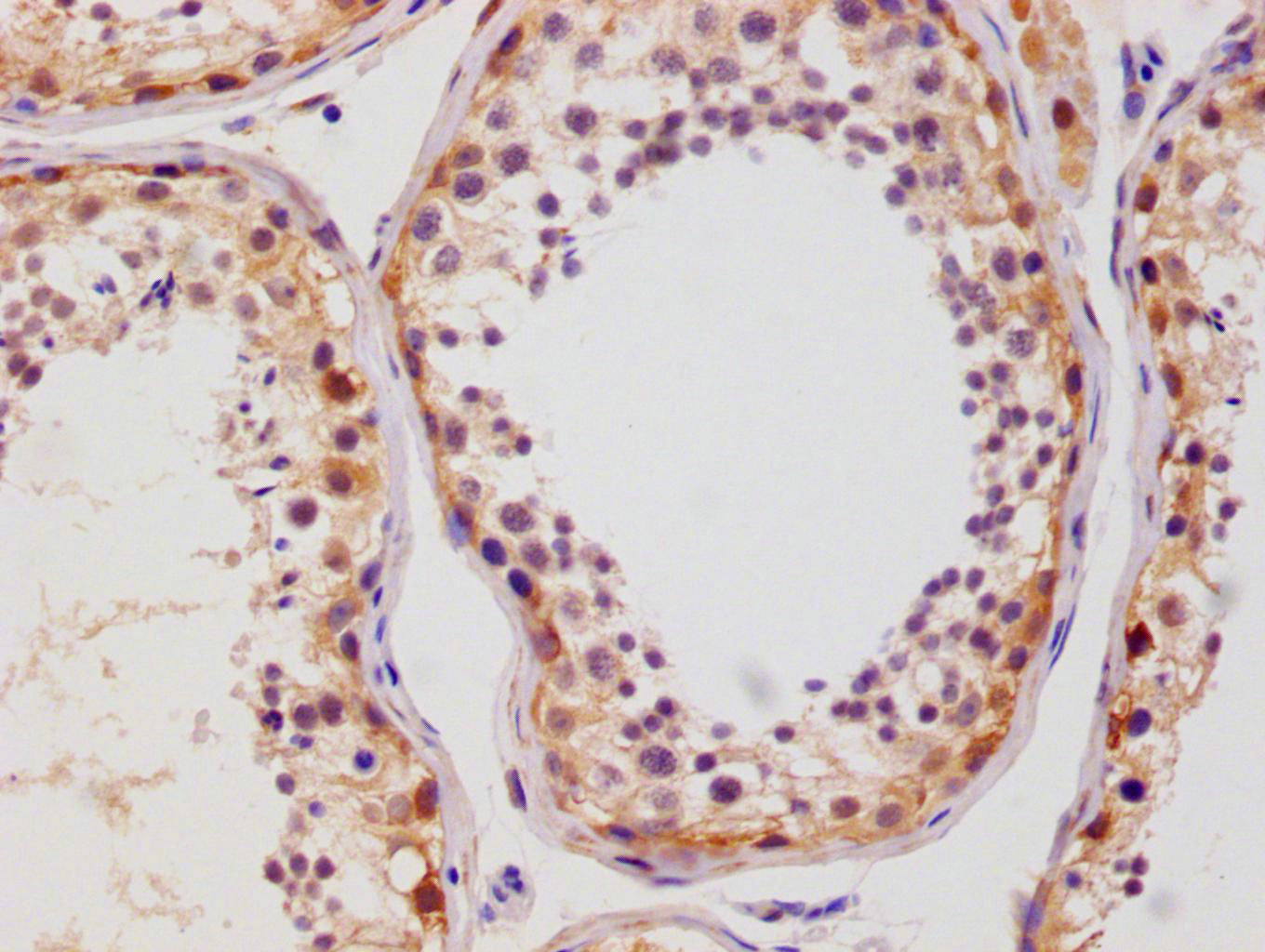 IHC image of RAC07744 diluted at 1:100 and staining in paraffin-embedded human testis tissue performed on a Leica BondTM system. After dewaxing and hydration, antigen retrieval was mediated by high pressure in a citrate buffer (pH 6.0). Section was blocked with 10% normal goat serum 30min at RT. Then primary antibody (1% BSA) was incubated at 4Â°C overnight. The primary is detected by a Goat anti-rabbit polymer IgG labeled by HRP and visualized using 0.05% DAB.