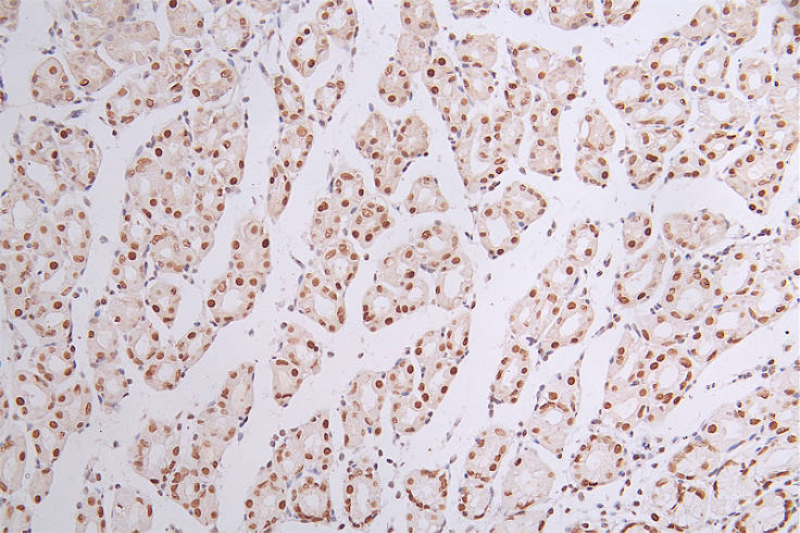 IHC image of RAC07746 diluted at 1:50 and staining in paraffin-embedded human stomach tissue performed on a Leica BondTM system. After dewaxing and hydration, antigen retrieval was mediated by high pressure in a citrate buffer (pH 6.0). Section was blocked with 10% normal goat serum 30min at RT. Then primary antibody (1% BSA) was incubated at 4Â°C overnight. The primary is detected by a Goat anti-rabbit polymer IgG labeled by HRP and visualized using 0.44% DAB.