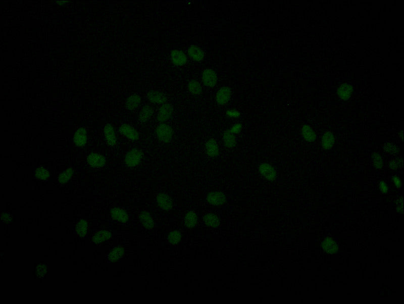 Immunofluorescence staining of Hela with RAC07746 at 1:20, counter-stained with DAPI. The cells were fixed in 4% formaldehyde and blocked in 10% normal Goat Serum. The cells were then incubated with the antibody overnight at 4Â°C. The secondary antibody was Alexa Fluor 511-congugated AffiniPure Goat Anti-Rabbit IgG(H+L).