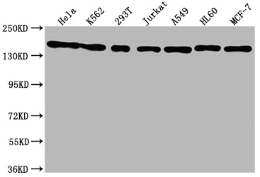 Western Blot; Positive WB detected in: Hela whole cell lysate, K562 whole cell lysate, 293T whole cell lysate, Jurkat whole cell lysate, A549 whole cell lysate, HL60 whole cell lysate, MCF-7 whole cell lysate; All lanes: SMC1A antibody at 1:1500; Secondary; Goat polyclonal to rabbit IgG at 1/50000 dilution; Predicted band size: 144 kDa; Observed band size: 144 kDa