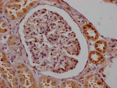 IHC image of RAC07748 diluted at 1:100 and staining in paraffin-embedded human kidney tissue performed on a Leica BondTM system. After dewaxing and hydration, antigen retrieval was mediated by high pressure in a citrate buffer (pH 6.0). Section was blocked with 10% normal goat serum 30min at RT. Then primary antibody (1% BSA) was incubated at 4? overnight. The primary is detected by a Goat anti-rabbit IgG polymer labeled by HRP and visualized using 0.05% DAB.