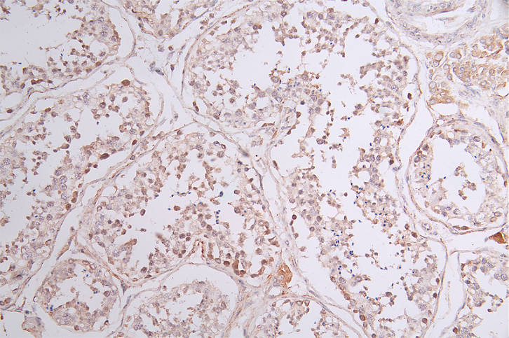 IHC image of RAC07750 diluted at 1:50 and staining in paraffin-embedded human testis tissue performed on a Leica BondTM system. After dewaxing and hydration, antigen retrieval was mediated by high pressure in a citrate buffer (pH 6.0). Section was blocked with 10% normal goat serum 30min at RT. Then primary antibody (1% BSA) was incubated at 4Â°C overnight. The primary is detected by a Goat anti-rabbit polymer IgG labeled by HRP and visualized using 0.43% DAB.