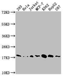 Western Blot; Positive WB detected in: 293 whole cell lysate, Hela whole cell lysate, Jurkat whole cell lysate, MCF-7 whole cell lysate, K562 whole cell lysate, HepG2 whole cell lysate, U87 whole cell lysate; All lanes: SOD1 antibody at 1:1500; Secondary; Goat polyclonal to rabbit IgG at 1/50000 dilution; Predicted band size: 16 kDa; Observed band size: 18 kDa